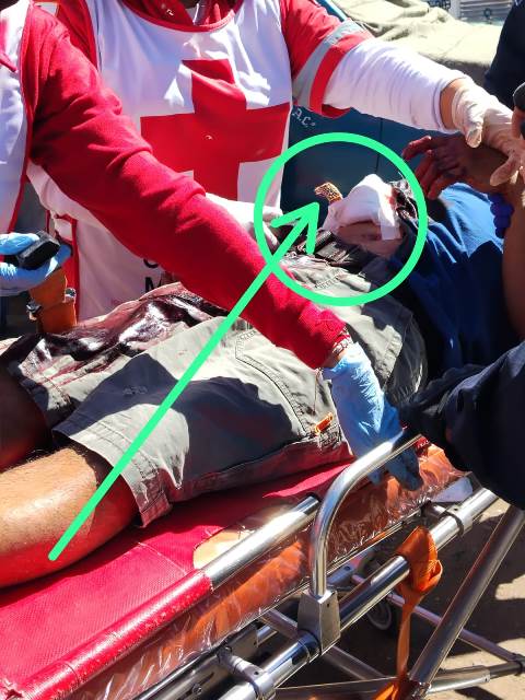 HOMBRE LESIONADO EN RIÑA CON ARMA BLANCA EN LA CENTRAL DE ABASTOS: FALTA DE VIGILANCIA EN LA ZONA